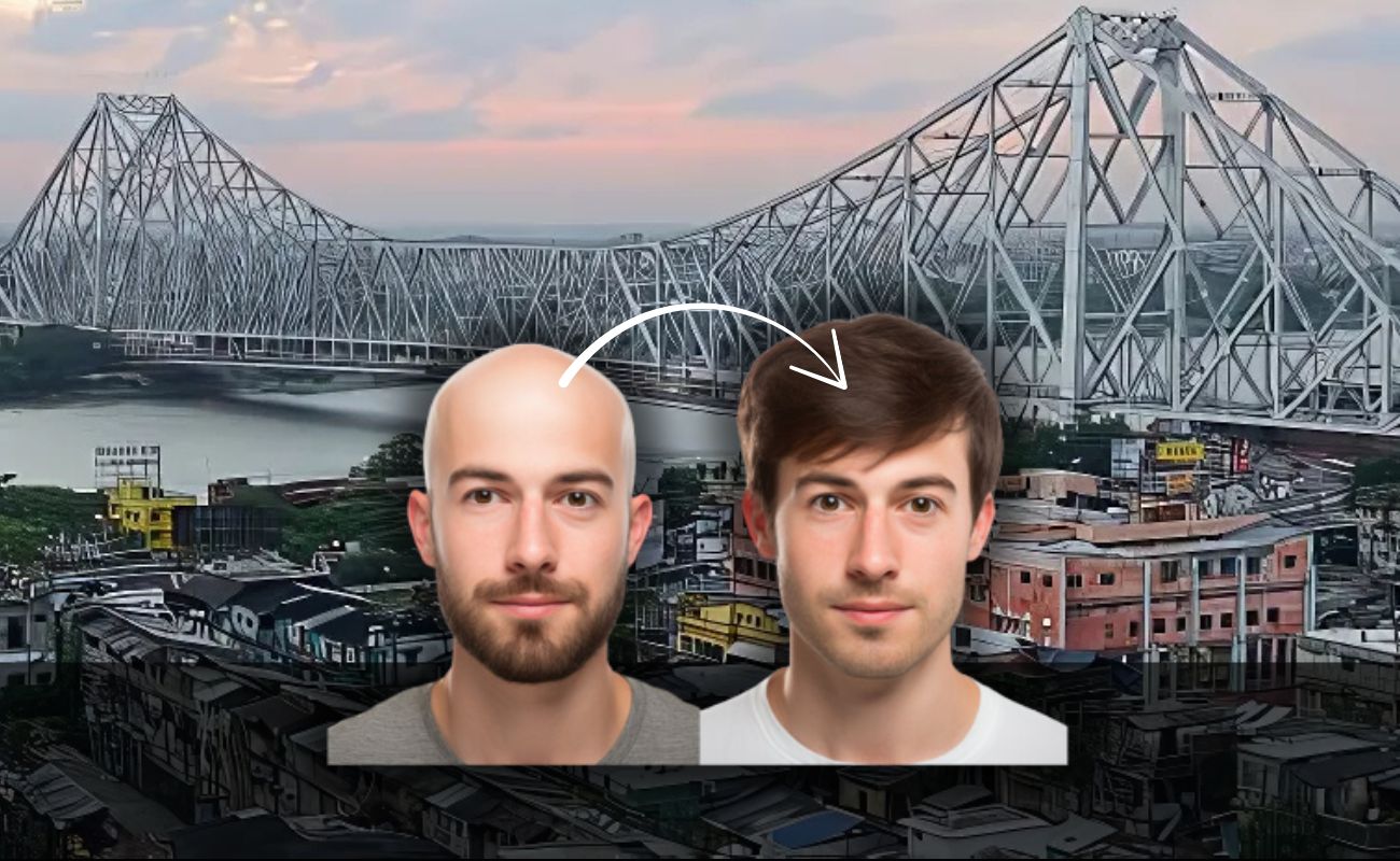hair-fixing-service-kolkata-best-hair-wig-fixing-center-for-men-in-south-kolkata